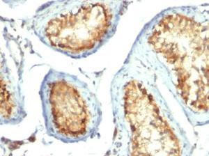 Immunohistochemical analysis of formalin-fixed, paraffin-embedded human testicular carcinoma using Anti-Mitochondria Antibody [113-1]