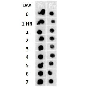 Dot blot analysis of human cell lysates using Anti-Amyloid Fibrils Antibody (A304905) at 1:500 and 1:5000. Beta Amyloid HEPES-NaCl aggregation, showing 1:500 (L) and 1:5,000 (R) time lapse Dot blot