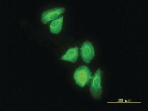 Anti-DNAJC3 Mouse Monoclonal Antibody [clone: 4D3-F2]