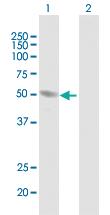 Anti-HERPUD1 Mouse Polyclonal Antibody