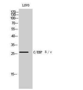 Western blot analysis of LOVO cells using Anti-CEBPD + CEBPE Antibody