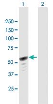 Anti-HERPUD1 Mouse Polyclonal Antibody