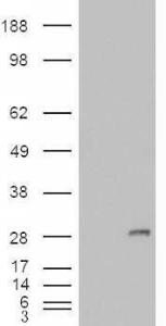 HEK293 overexpressing IGFBP6 (RC204060) and probed with Anti-IGFBP6 Antibody (A84511) (mock transfection in first lane), tested by Origene