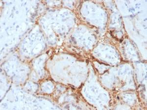 Immunohistochemical analysis of formalin-fixed, paraffin-embedded human placenta using Anti-HIF1 alpha Antibody [Ha111a]