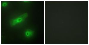 Immunofluorescence analysis of HeLa cells using Anti-TALL-2 Antibody. The right hand panel represents a negative control, where the antibody was pre-incubated with the immunising peptide