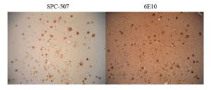 Immunohistochemistry analysis of human alzheimer. The Primary Antibody used was Anti-Amyloid Fibrils Antibody (A304905) at 1:100. Showing no Amyloid Precursor Protein (APP) cross-reactivity (L), but when conducted with monoclonal 6E10 (R) shows considerable APP cross-reactivity