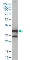 Anti-NQO1 Mouse Monoclonal Antibody [clone: 1E3-A6]