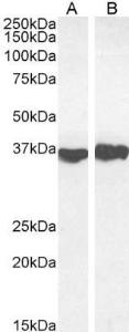 Anti-GAPDH antibody