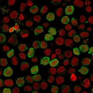 Anti-Calponin 1 antibody