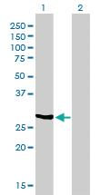 Anti-NQO1 Mouse Monoclonal Antibody [clone: 1E3-A6]