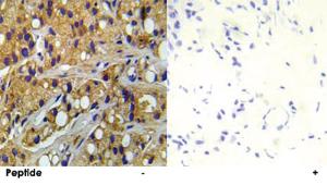 Anti-TSC2 Rabbit Polyclonal Antibody