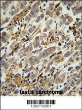 Anti-ASB17 Rabbit Polyclonal Antibody (AP (Alkaline Phosphatase))