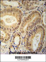 Anti-RBM24 Rabbit Polyclonal Antibody