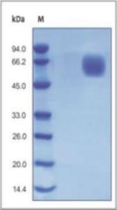 The purity of rh FGFR4 was determined by DTT-reduced (+) SDS-PAGE and staining overnight with Coomassie Blue.