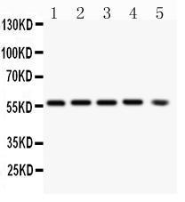 Anti-PKB alpha Mouse Monoclonal Antibody [clone: IML-26]