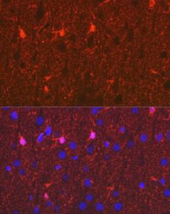 Immunohistochemistry analysis of paraffin-embedded human colonic peripheral nerve using Anti-S100 beta Antibody [ARC50351] (A307742) at a dilution of 1:100 (40x lens)