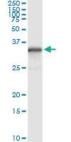 Anti-NQO1 Mouse Monoclonal Antibody [clone: 1E3-A6]