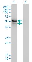 Anti-HERPUD1 Mouse Monoclonal Antibody [clone: 3E10]