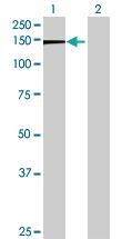 Anti-FAM13B Mouse Polyclonal Antibody