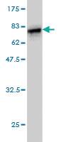 Anti-HORMAD1 Mouse Monoclonal Antibody [clone: 2E5]