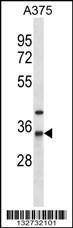 Anti-NAT1 Rabbit Polyclonal Antibody (HRP (Horseradish Peroxidase))