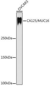 Western blot analysis of extracts of OVCAR3 cells, using Anti-MUC16 Antibody [ARC1083] (A308979) at 1:1,000 dilution