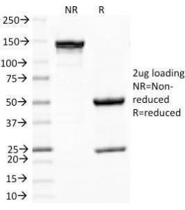 SDS-PAGE analysis of Anti-PNL2 Antibody [PNL2] under non-reduced and reduced conditions; showing intact IgG and intact heavy and light chains, respectively. SDS-PAGE analysis confirms the integrity and purity of the Antibody