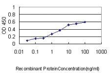 Anti-HERPUD1 Mouse Monoclonal Antibody [clone: 3E10]