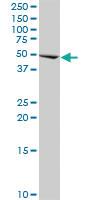 Anti-CIR1 Mouse Monoclonal Antibody [clone: 2E11]