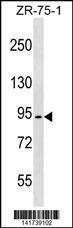 Anti-MEFV Rabbit Polyclonal Antibody (PE (Phycoerythrin))