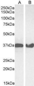 Anti-GAPDH antibody