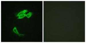 Immunofluorescence analysis of HeLa cells using Anti-PEA-15 Antibody. The right hand panel represents a negative control, where the antibody was pre-incubated with the immunising peptide.