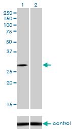 Anti-NQO1 Mouse Monoclonal Antibody [clone: 1E3-A6]