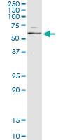 Anti-MAPK8 Antibody Pair