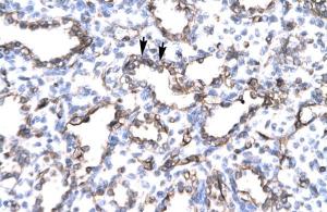 Anti-ENG Rabbit Polyclonal Antibody