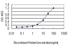 Anti-NQO1 Mouse Monoclonal Antibody [clone: 1E3-A6]