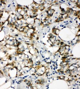 Anti-Cytokeratin 8 Rabbit Polyclonal Antibody