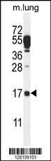 Anti-DTD2 Rabbit Polyclonal Antibody (HRP (Horseradish Peroxidase))