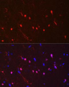 Immunohistochemistry analysis of paraffin-embedded mouse brain using Anti-S100 beta Antibody [ARC50351] (A307742) at a dilution of 1:100 (40x lens)