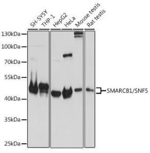 Western blot analysis of extracts of various cell lines, using Anti-SNF5 / SMARCB1 Antibody (A308980) at 1:1,000 dilution. The secondary antibody was Goat Anti-Rabbit IgG H&L Antibody (HRP) at 1:10,000 dilution.