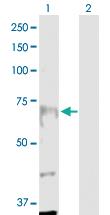 Anti-ANKRD17 Rabbit Polyclonal Antibody