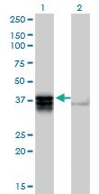 Anti-TRDD3 Mouse Polyclonal Antibody