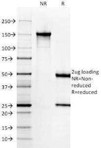 SDS-PAGE analysis of Anti-MYH11 Antibody [SMMS-1] under non-reduced and reduced conditions; showing intact IgG and intact heavy and light chains, respectively SDS-PAGE analysis confirms the integrity and purity of the antibody