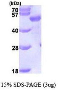 Human recombinant p62/SQSTM1 (from <i>E. coli</i>)