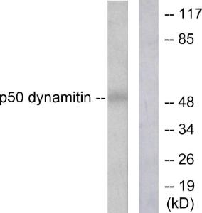 Anti-Dynamitin Rabbit Polyclonal Antibody