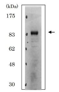 Anti-CDT2 Antibody