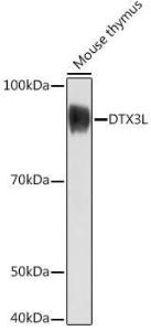 Western blot analysis of extracts of Mouse thymus, using Anti-DTX3L Antibody (A308981) at 1:1,000 dilution. The secondary antibody was Goat Anti-Rabbit IgG H&L Antibody (HRP) at 1:10,000 dilution.