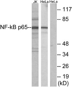 Anti-NF-kB p65 Rabbit Polyclonal Antibody