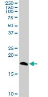 Anti-NPC2 Mouse Polyclonal Antibody