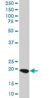 Anti-TRDD3 Mouse Polyclonal Antibody